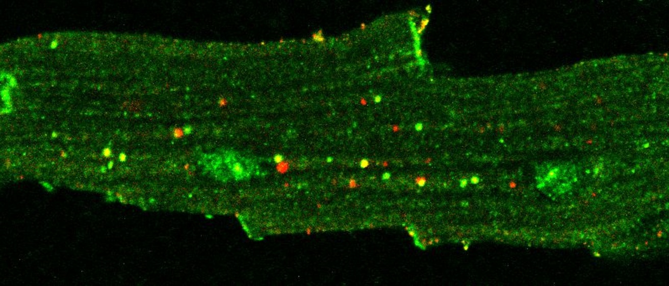 Anderson Lab- Cardiometabolic Disorders and Therapeutic Development ...